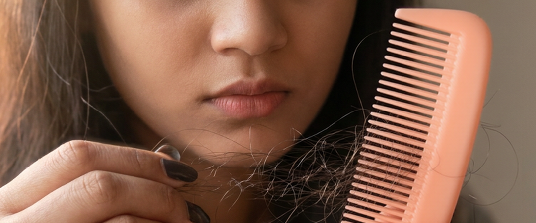 Homeopathy for Hair Fall and Scalp Concerns: A Detailed Guide